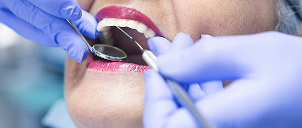 Best Emergency Root Canal Treatment in Pikeville, TN